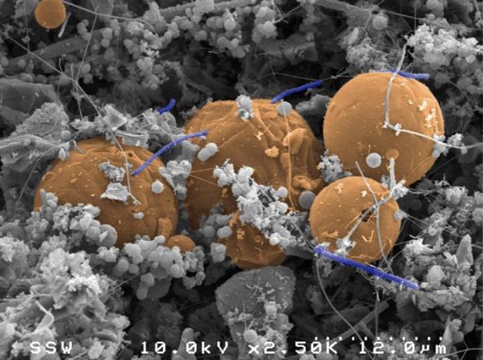 The bacterium Candidatus Desulforudis audaxviator (the purplish, blue rod-shaped cells straddling orange carbon spheres) survives on hydrogen and was found in a fluid & gas-filled fracture 2.8 km beneath Earth's surface at a mine near Johannesburg, South Africa. / Credit: Greg Wanger, California Institute of Technology, USA, and Gordon Southam University of Queensland, Australia