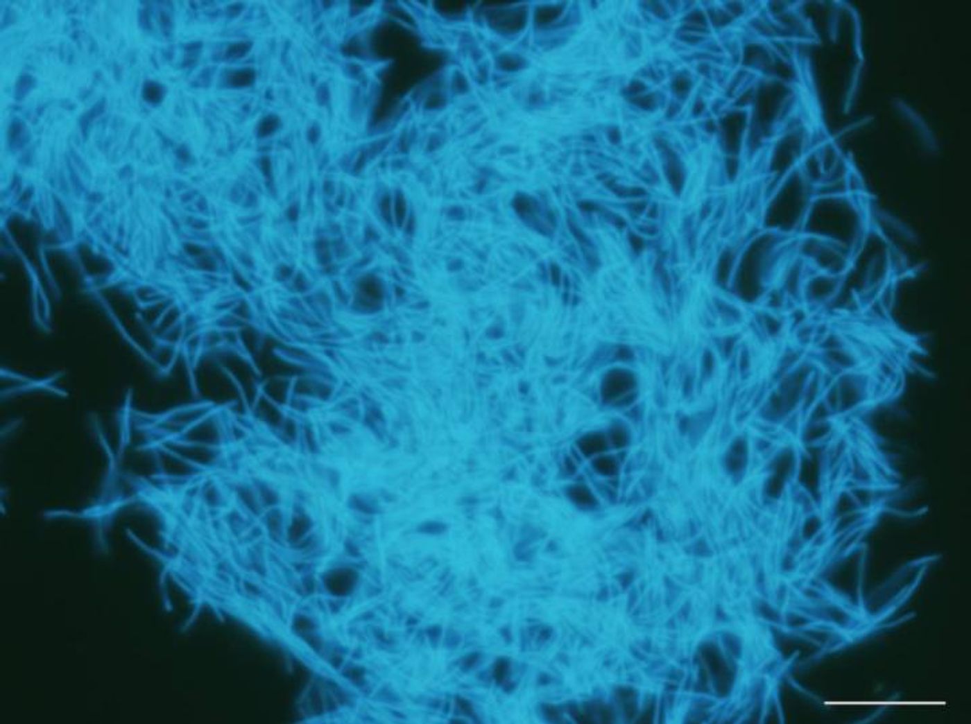 A species of Methanobacterium, which produces methane, and was found in samples from a buried coal bed 2 km below the Pacific Ocean floor off the coast of Japan / Credit: Hiroyuki Imachi (Japan Agency for Marine-Earth Science and Technology