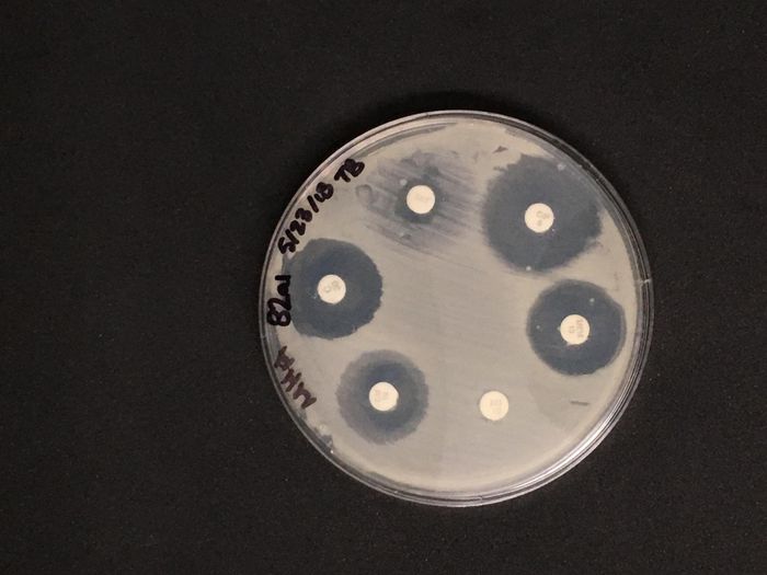 This photo shows a disc diffusion test, where each disc contains a different antibiotic. The discs covered in growing bacteria contain bacteria that are resistant to antibiotics. / Credit: Taylor Brown/Northwestern University