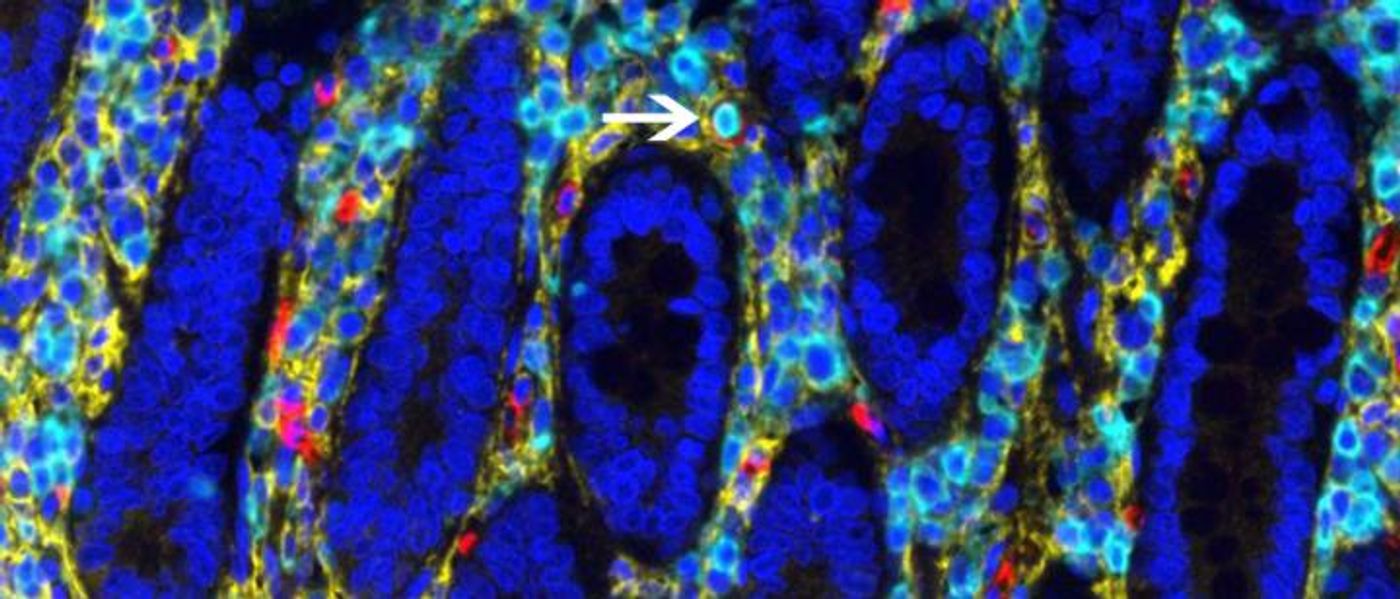 Human HSCs in intestine. / Credit: Megan Sykes/Columbia University