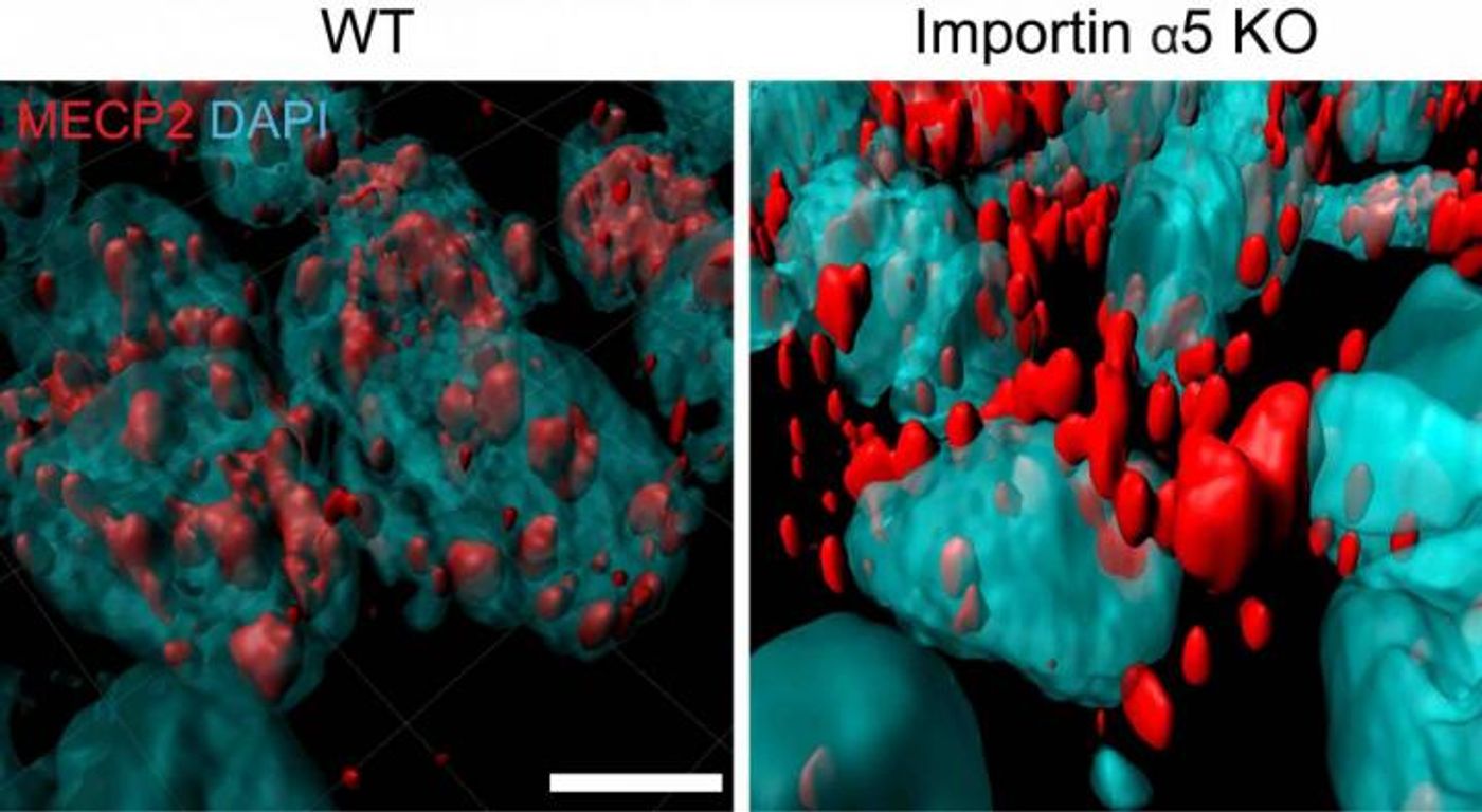 In mice without importin alpha-5 (right), MeCP2 (red, known to affect anxiety behaviors), remains outside of nuclei (blue) of brain neurons, instead of getting inside nuclei, like in regular mice (left). / Credit: Weizmann Institute of Science