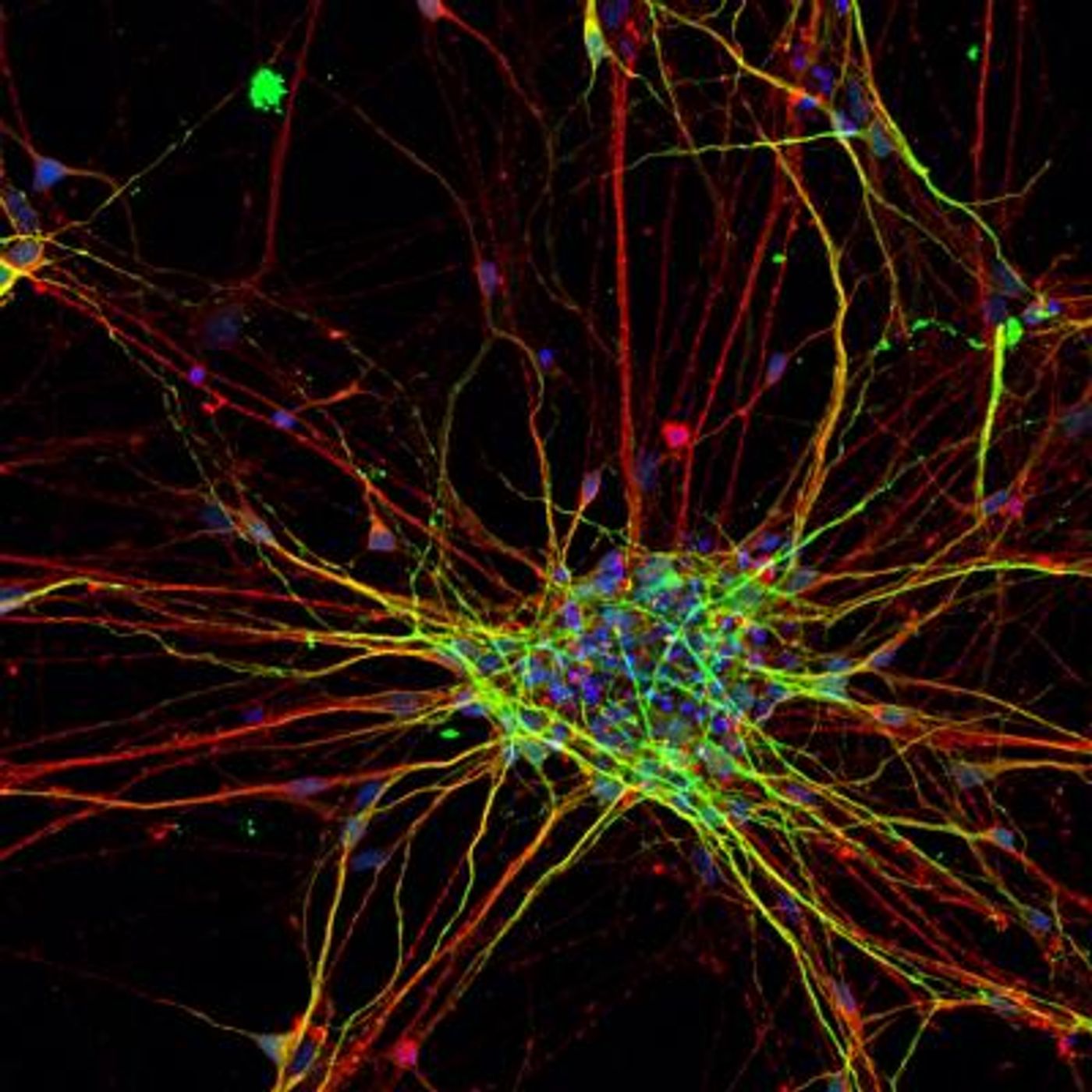 This image shows a two-dimensional culture of subject-derived cortical neurons stained for neuronal markers MAP2 (red) and Tuj1 (green). / Credit: Salk Institute