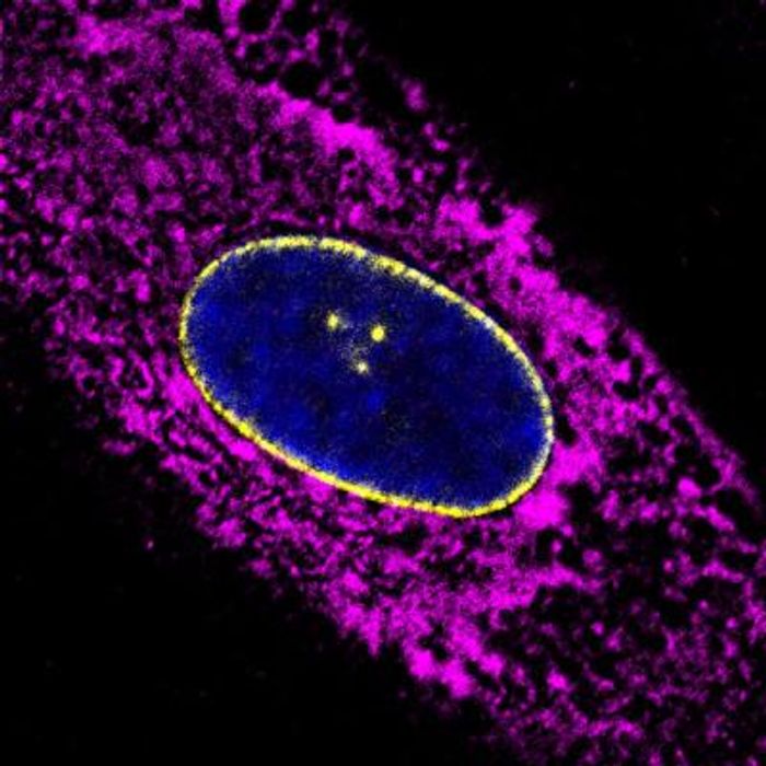 A human fibroblast cell line was derived from a skin biopsy. To confirm cell identity, staining was performed for a fibroblast marker (SERPINH1, magenta), nuclear pore complexes (Nup153, yellow) and DNA (DAPI, blue).  CREDIT Roberta Schulte/Swati Tyagi/Salk Institute.