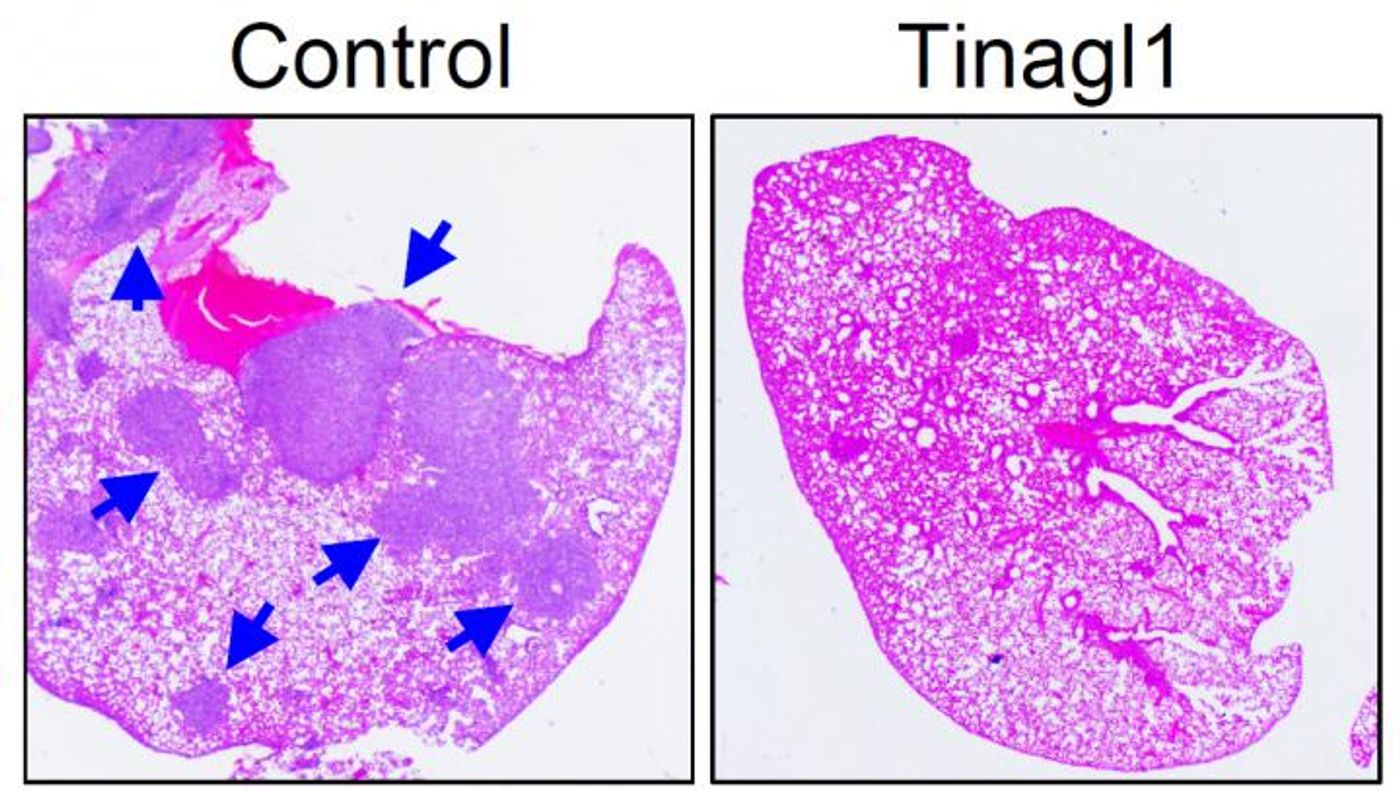 Treatment with recombinant Tinagl1 protein significantly suppressed lung metastasis, as shown by the blue arrows in mice with (right) or without (left) Tinagl1 treatment. / Credit: Image courtesy of Yibin Kang et al., Princeton University