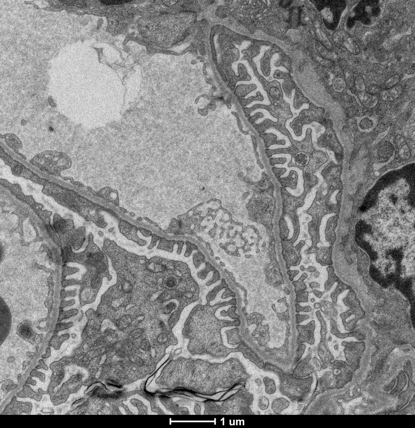 This is a transmission electron microscopic picture of the filtration barrier of the kidney- foot processes of podocytes shown throughout. / Credit: Richard Coward