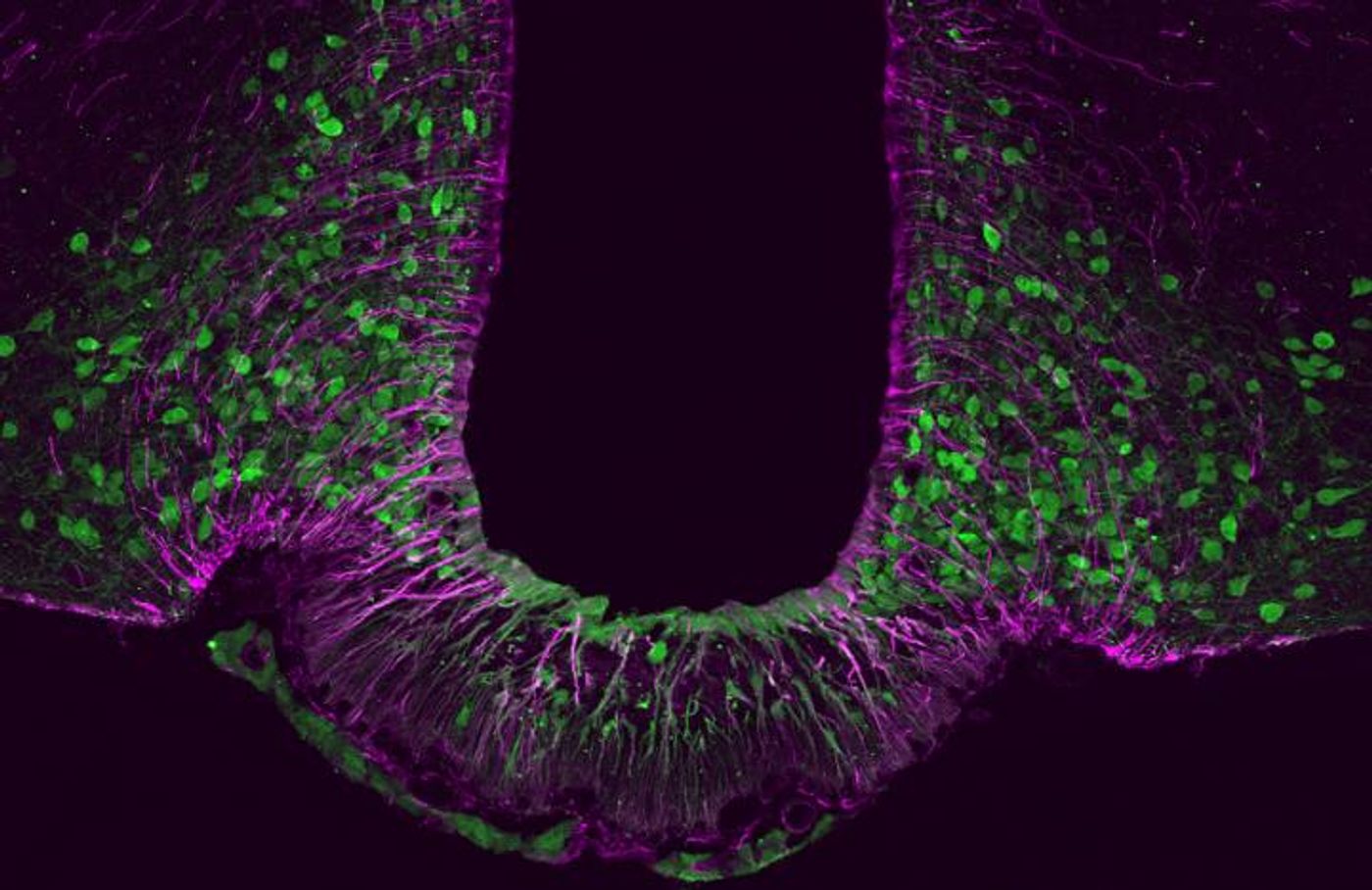 Tbx3 (green) plays a crucial role for the function and maintenance of satiety neurons in the brain. / Credit: modified from Quarta, C. & Fisette, A. et al. (Nature Metabolism)