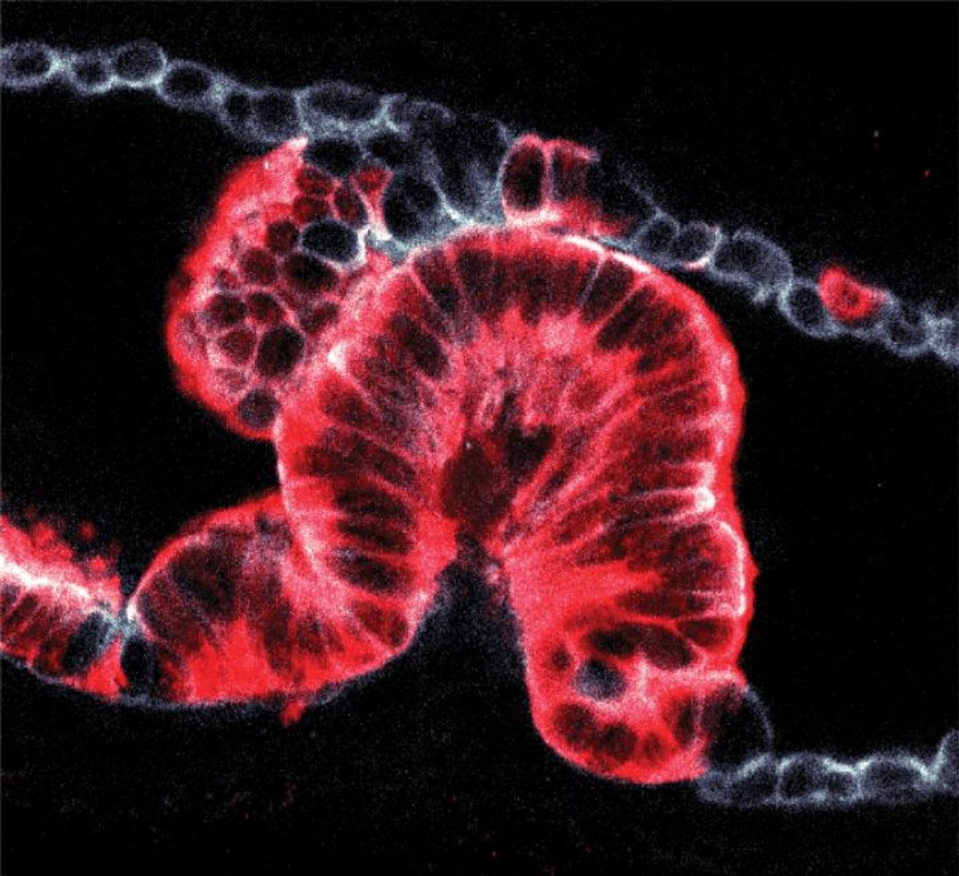 The image shows cancer growing inside the pancreatic duct of a mouse. It was obtained using a new technique to study 3D tissue samples, revealing that cancers can begin as 'endophytic' tumours which grow into the ducts (shown here) or 'exophytic' tumours growing outwards. / Credit: Hendrik Massal, Francis Crick Institute