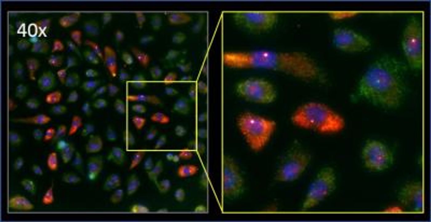 A population of human lung cells: nuclei (blue), RNA transcripts of MYC (red), a downstream gene (green). Credit: Simona Patange/Larson Lab