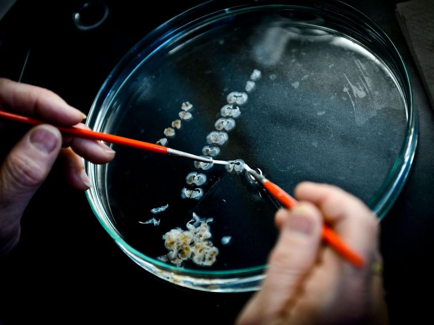 Sections of rat brain transplanted with human cells in a preclinical model of PD are being prepared for analysis. / Credit: Claire Henchcliffe