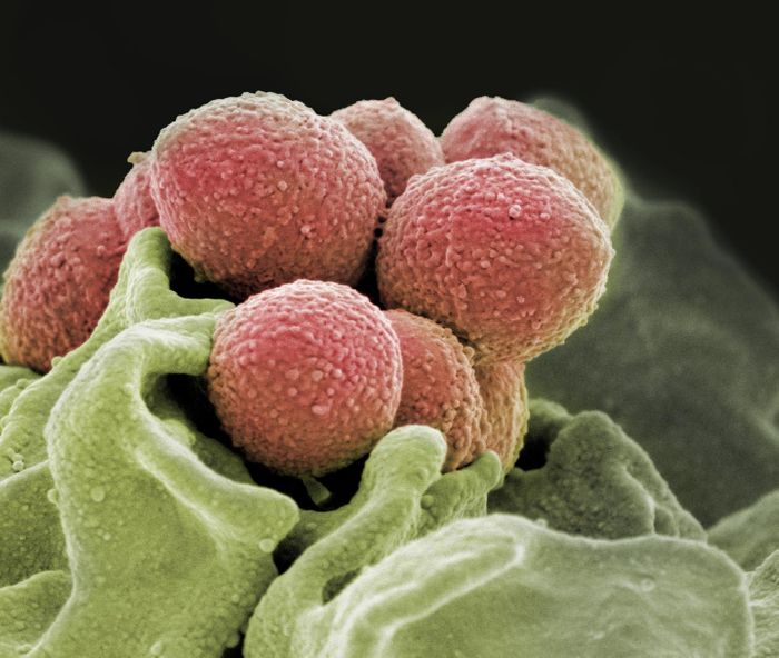 This is a scanning electron microscope image of Staphylococcus pyogenes bacteria (pink). / Credit: NIH National Institute of Allergy and Infectious Diseases (NIAID)