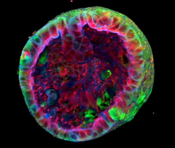 A kidney organoid. / Credit: Anne Rios (Princess Maxima Centre) in Nature Biotechnology