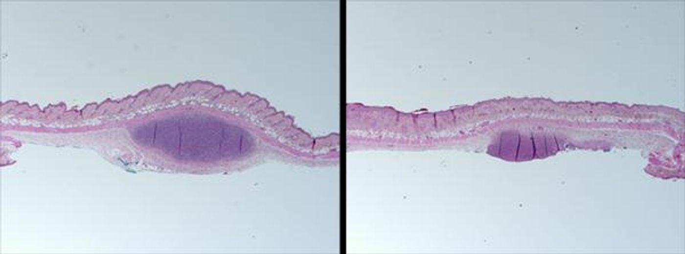 Mouse skin treated with synthetic human sebum, administered with strains of either acne-associated P. acnes (left) or health-associated P. acnes (right), and viewed under a microscope./ Credit: UC San Diego Health