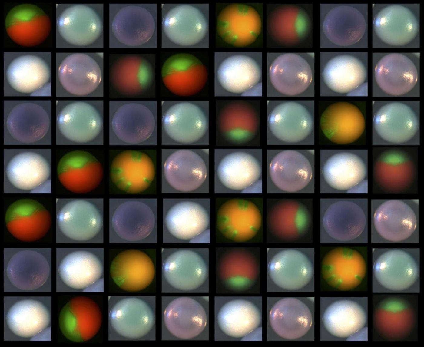 Candida albicans samples from patients often lack one copy of EFG1 in a genetic hotspot. They can then lose the other copy and adapt to vastly different environments. White, turquoise, lavender and purple colonies are from strains grown on a special kind of agar. Orange/green images show colonies with fluorescent reporters linked to the hotspot. / Credit: Bennett Lab/Brown University