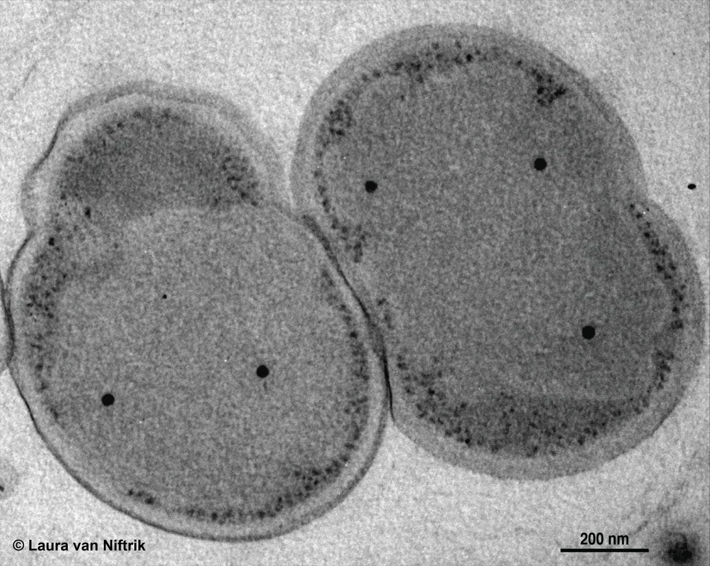 Kuenenia stuttgartiensis, here seen under a transmission electron microscope, is a model anammox microorganism, which grows as single cells. It is a freshwater species also found in wastewater treatment plants. / Credit: Laura van Niftrik