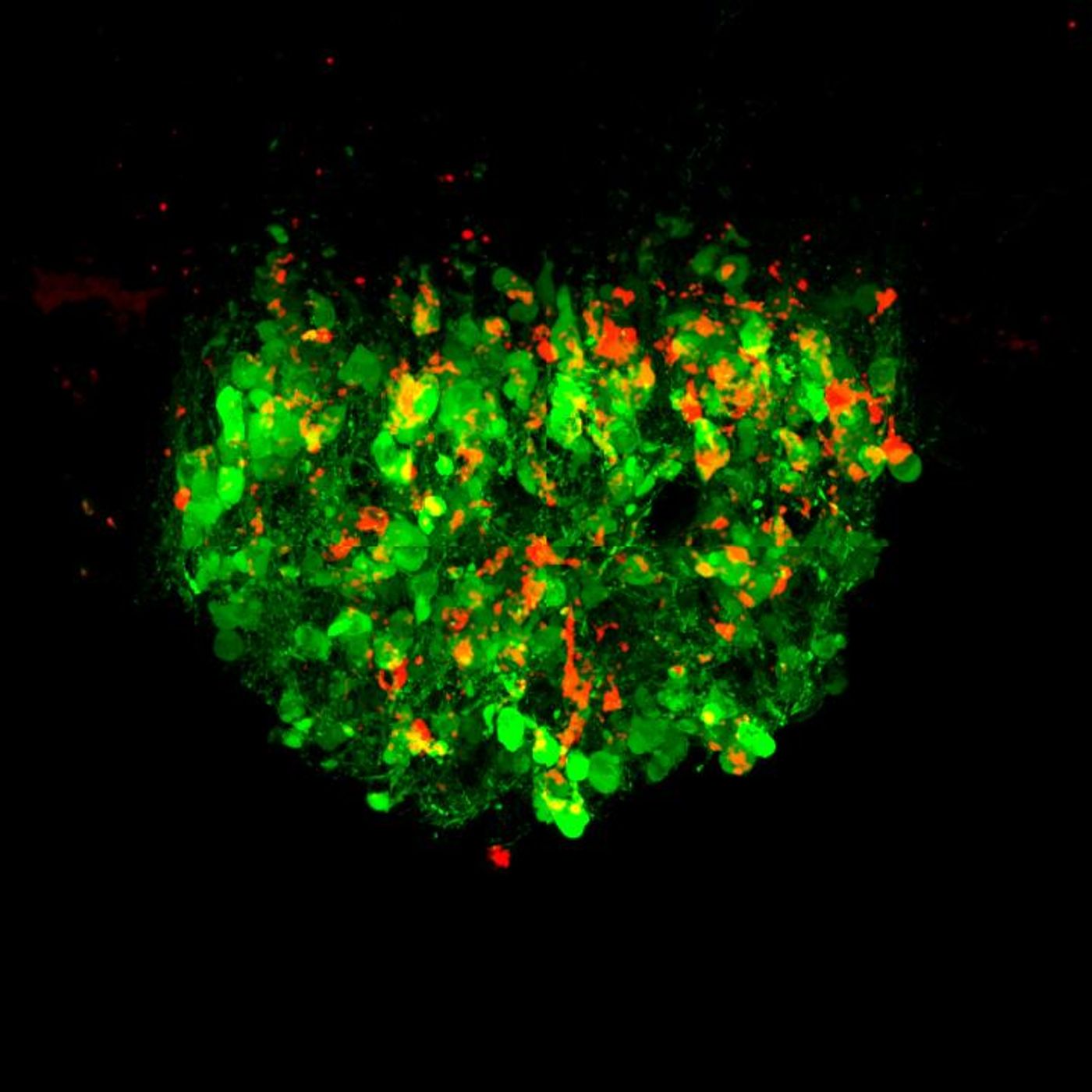 Neurons that control thirst in the mouse brain are switched on (green and red) when the gut senses salty fluid. / Credit: Knight Lab/UCSF/HHMI
