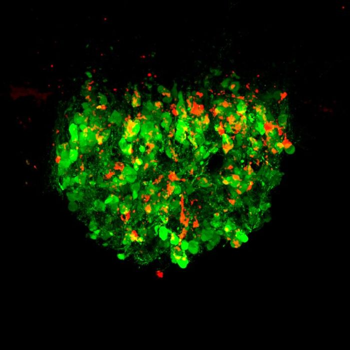 Neurons that control thirst in the mouse brain are switched on (green and red) when the gut senses salty fluid. / Credit: Knight Lab/UCSF/HHMI