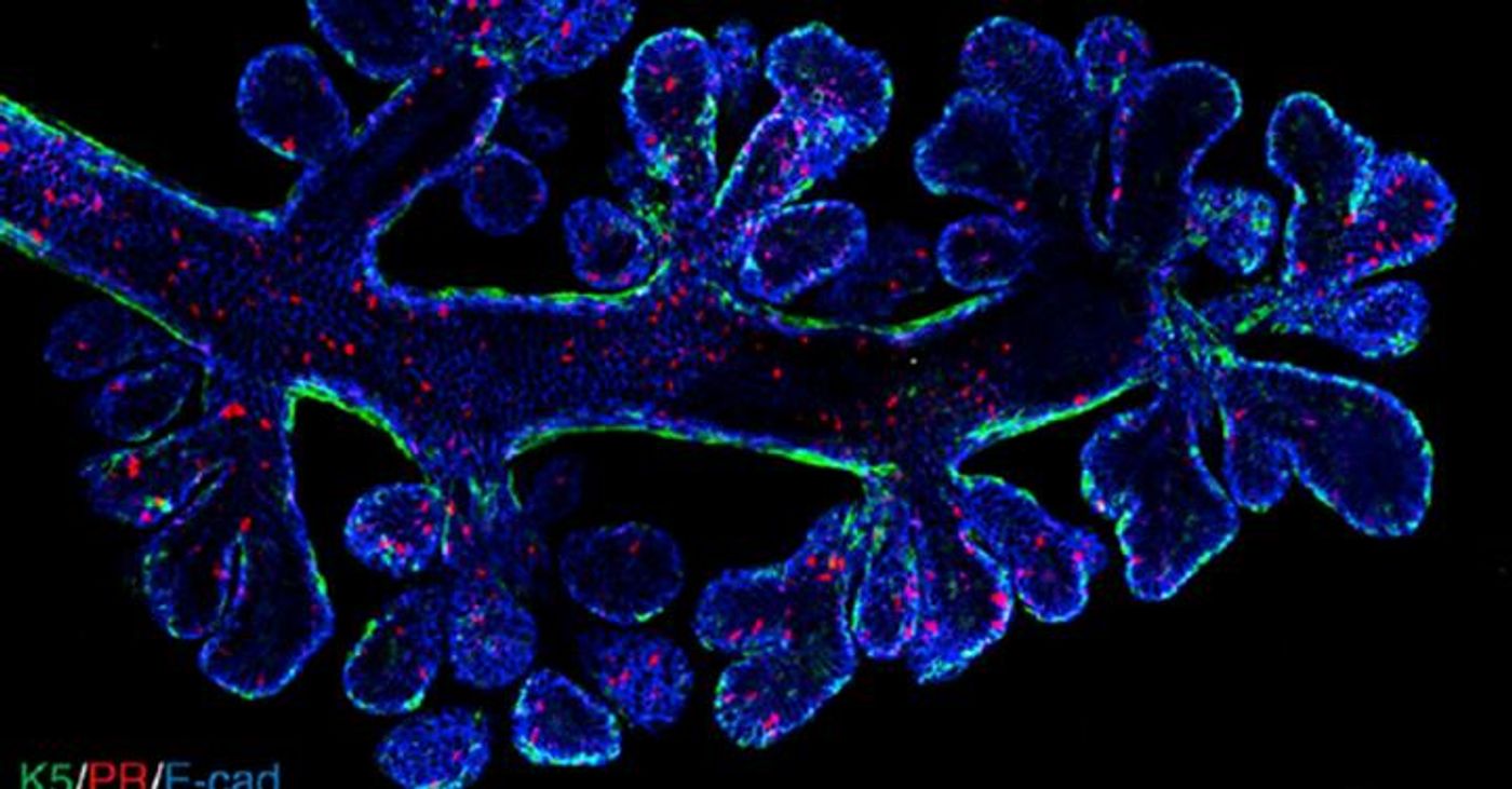 Researchers created a new imaging technique to visualize key steps the evolution of cancer cells within tumors, which has been used to reveal the intricate structure of mammary ducts and may show how breast cancers evade treatment. / Credit: Rios, Visvader et al, published in Cancer Cell