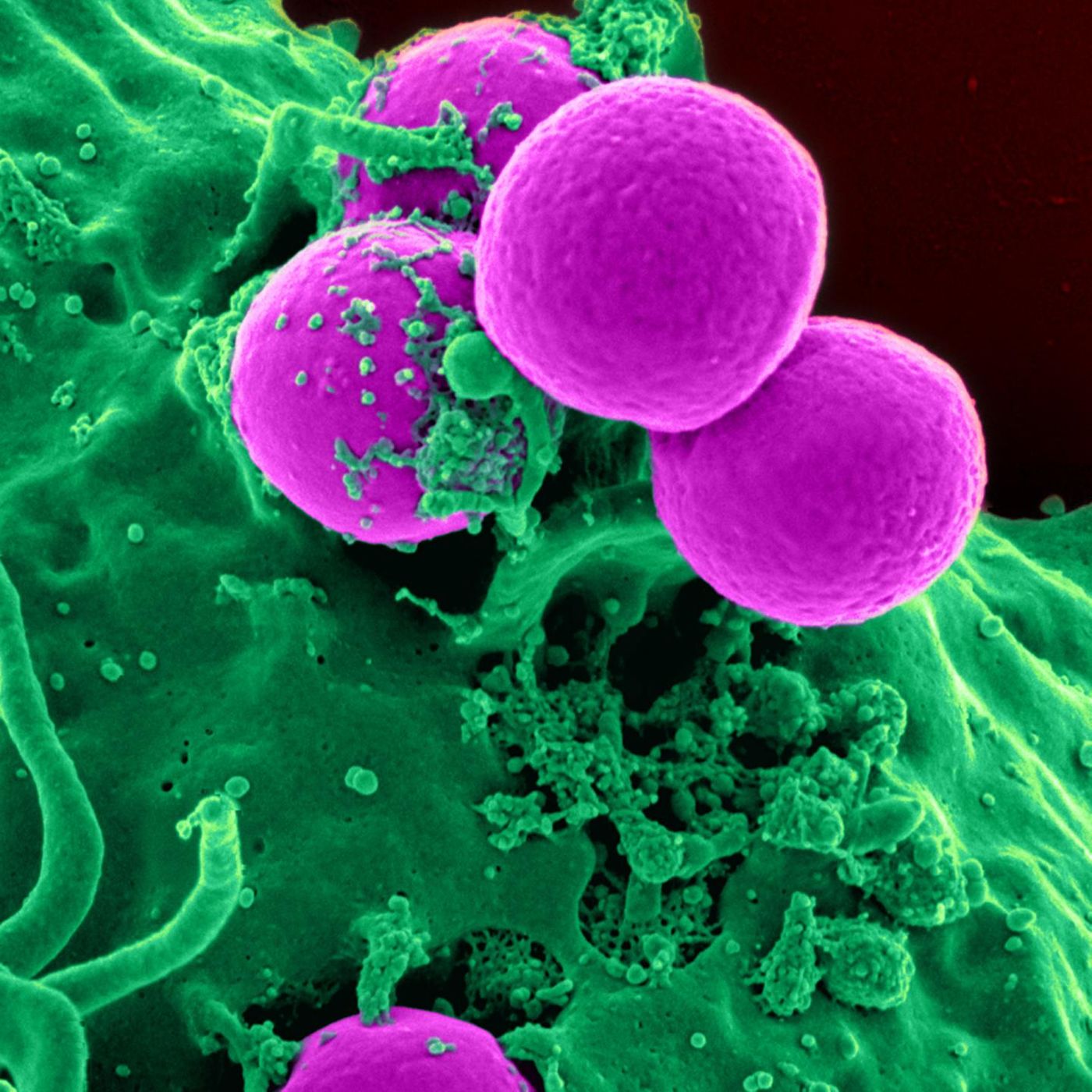 MRSA, pictured here, has developed resistance to certain antibiotic treatments. / Credit: National Institutes of Health (NIH)
