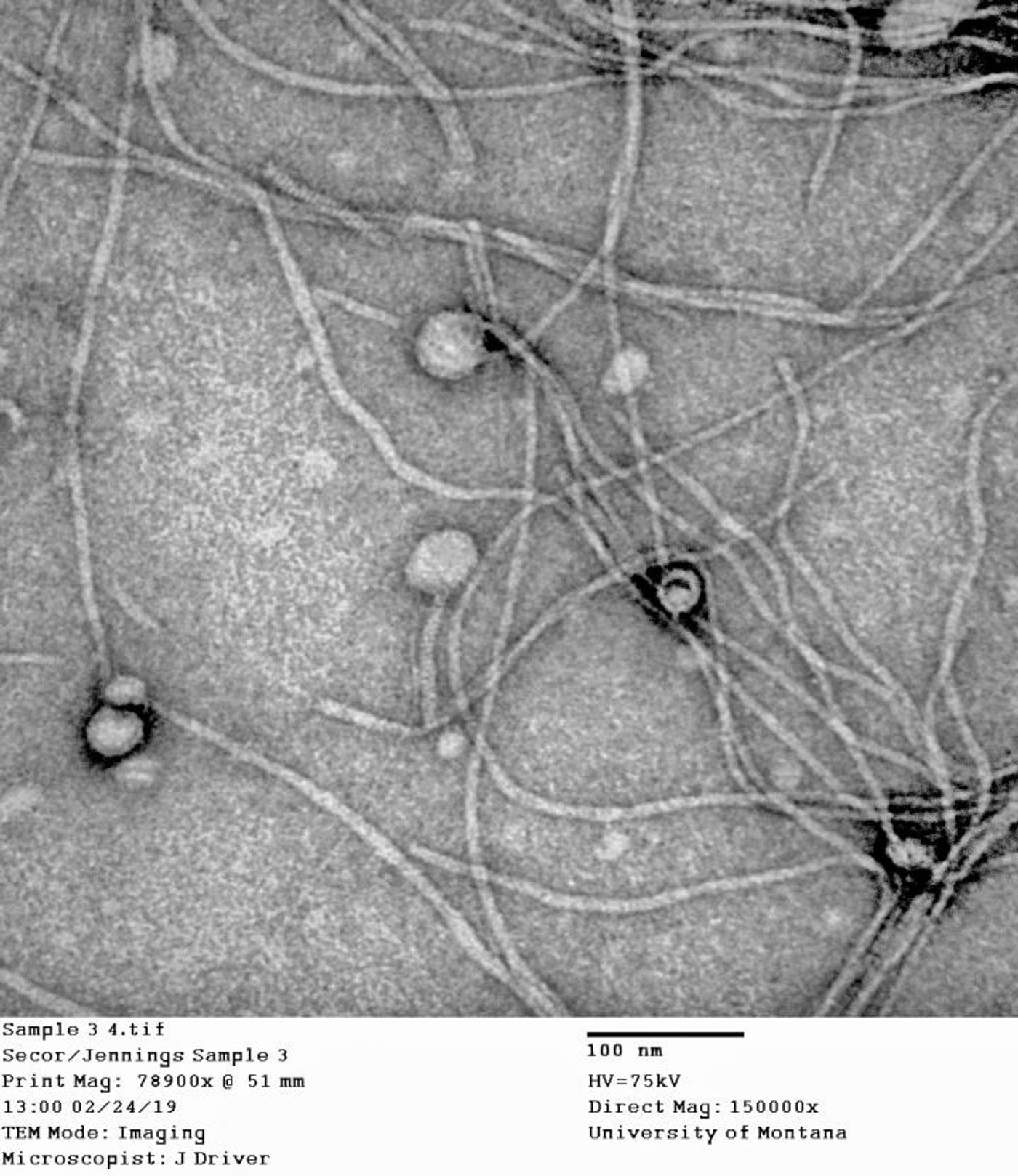 Multiple filamentous PF bacteriophage virions under an electron microscope. University of Montana researchers published new insights in the Journal Science on how bacteria cause infections, which may help with future infection treatments. / Credit: University of Montana