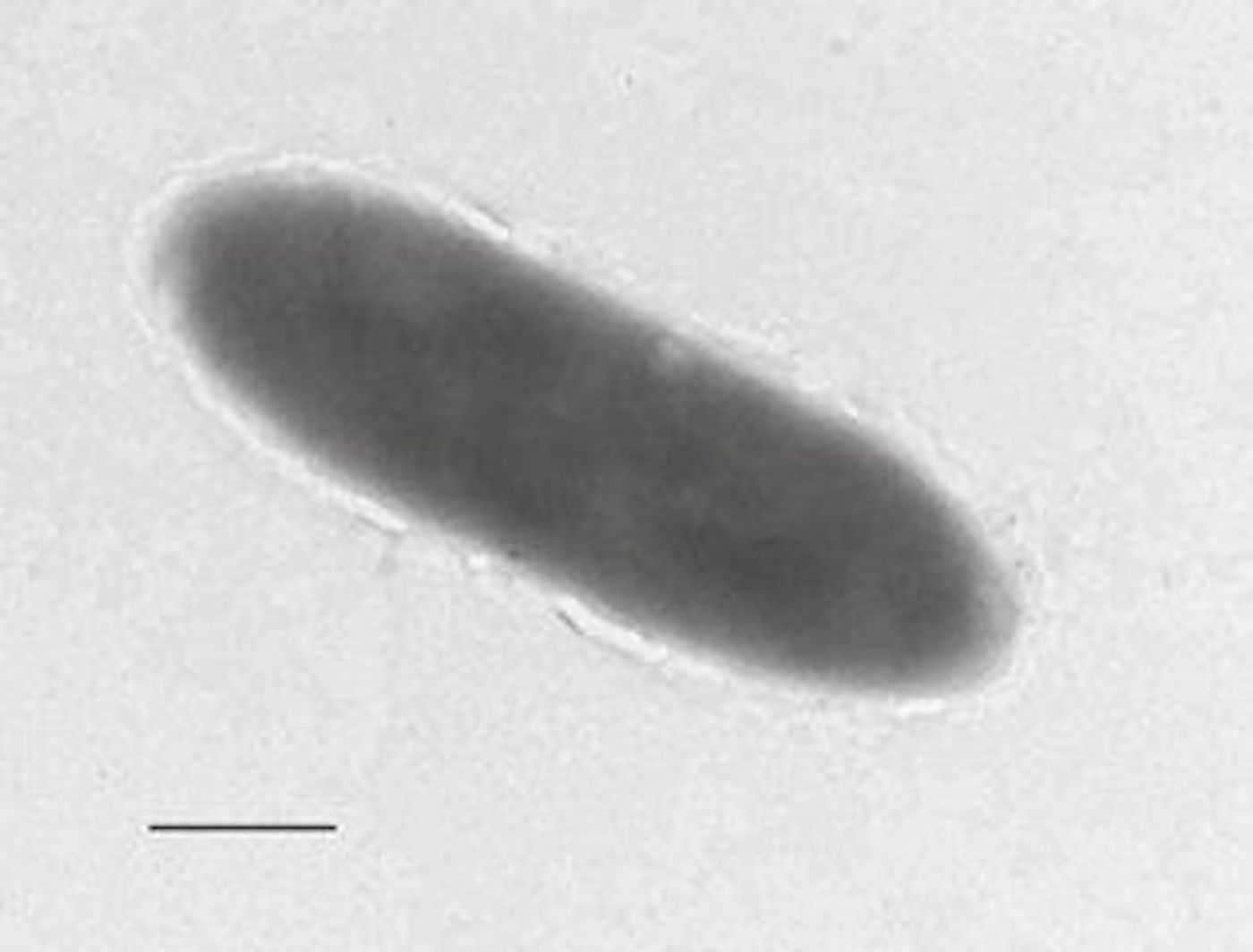 An expedition to collect samples of the microbial population at the deepest part of the Mariana Trench (some 11,000 meters down) has revealed a new 'oil-eating' bacteria. / Credit: University of East Anglia