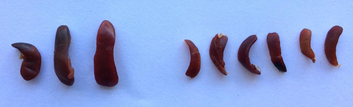 Muckle-Well syndrome mouse spleens after treatment with a ChoK inhibitor; inflammation is reduced as shown by the smaller spleens (right), compared to large, mock-treated mice (left). / Credit: UC San Diego