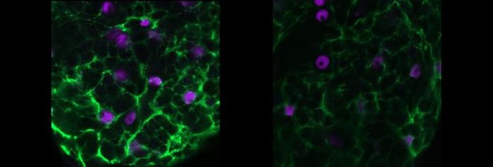 Staining of cortex glia show much less of the protein sandman (green) in the zyd mutant flies (right) vs. the typical "wild-type" flies (left)./ Credit:  Shirley Weiss/Troy Littleton/MIT