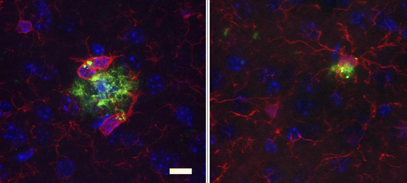 Long-term antibiotic treatment (right) reduces amyloid plaque size (green), alters microglia (red) in the brains of male mice compared to control (left). / Credit: Dodiya et al., 2019