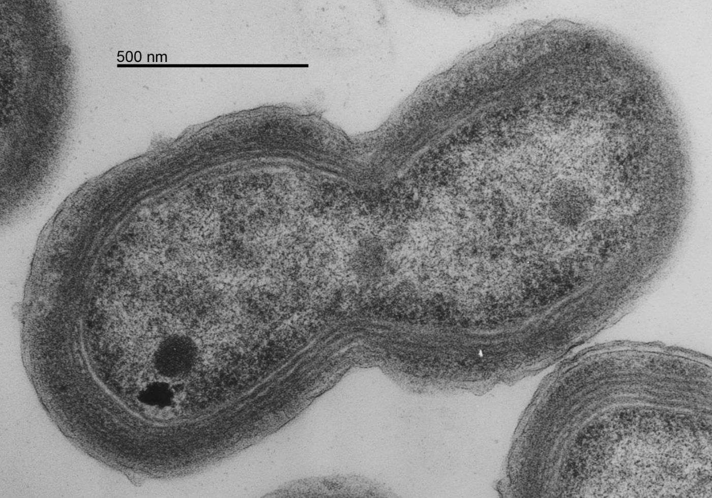 Credit: This is Prochlorococcus MED4 EM dividing. Taken by Luke Thompson (Chisholm Lab, MIT) and Nicki Watson (Whitehead Institute), 2006. TEM of MED4