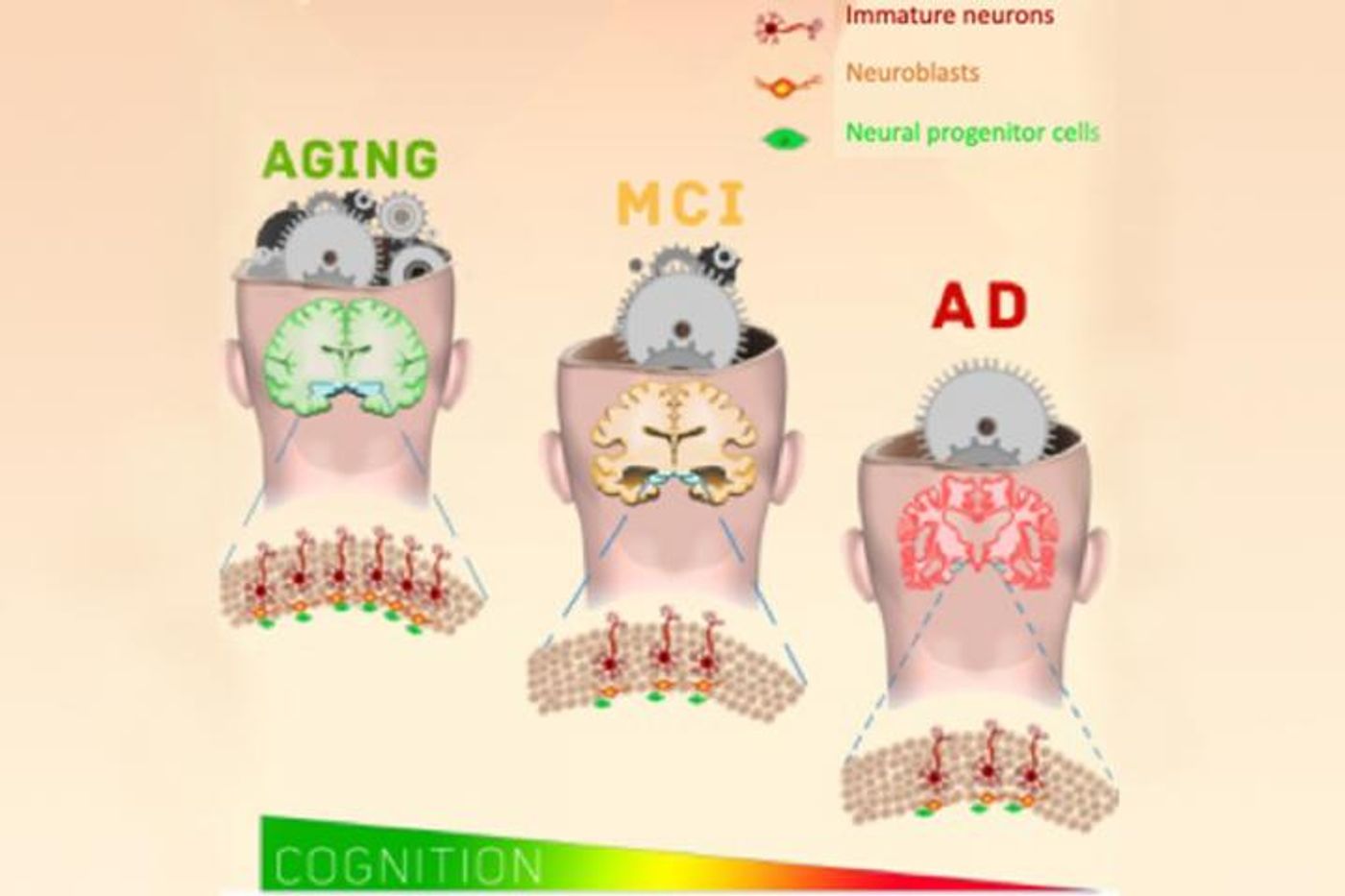 New neurons continue to be formed in the hippocampus into the tenth decade of life, even in people with mild cognitive impairment and Alzheimer's disease. / Credit: Orly Lazarov, et al