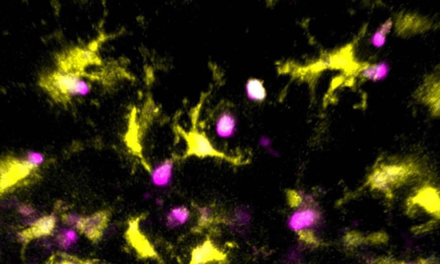 Developing killer T-cells (purple and white) are tested by dendritic cells (yellow), and others, to see if they react to normal proteins from the body. / Credit: University of Texas at Austin