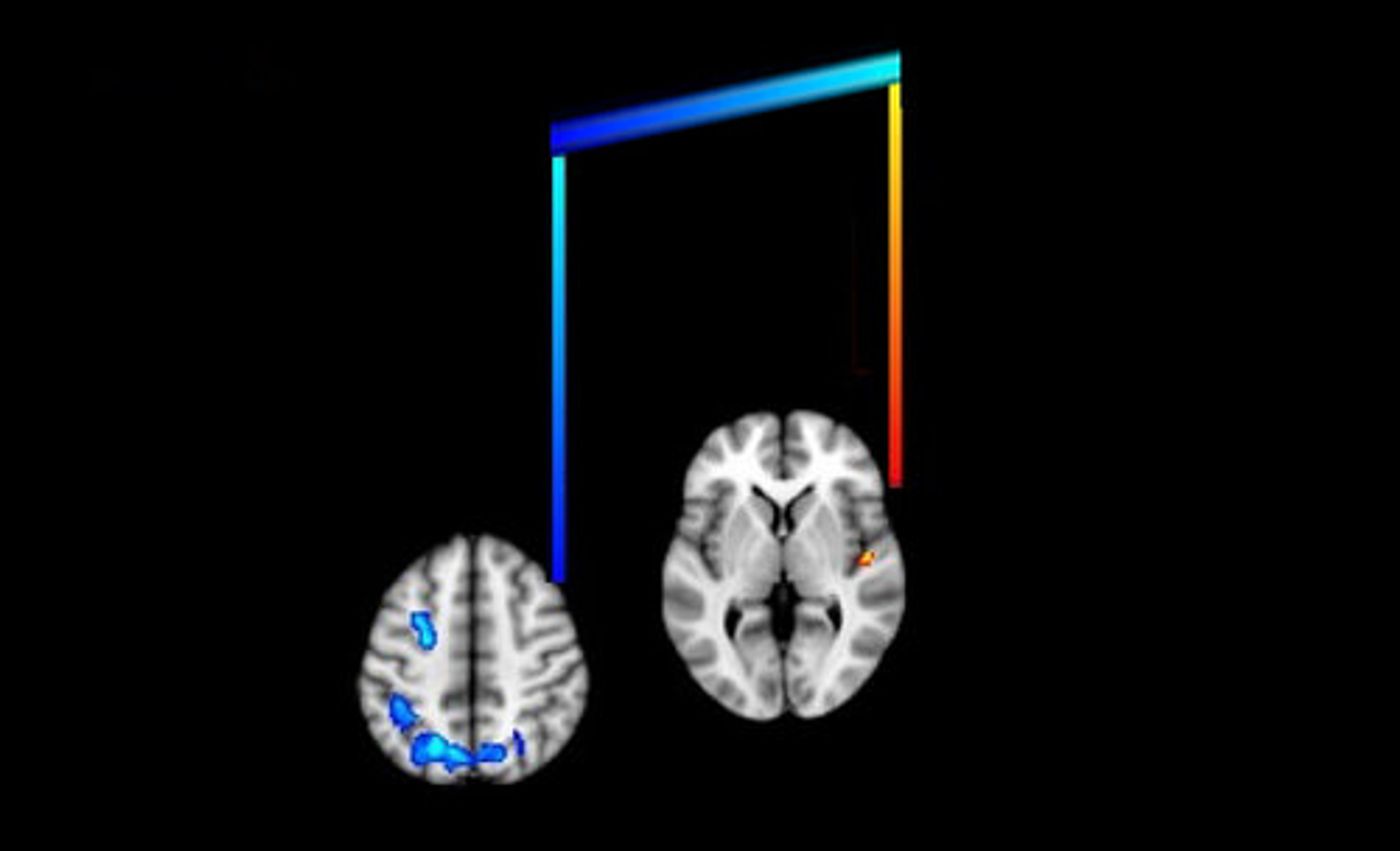 Music can unlock memories for dementia patients