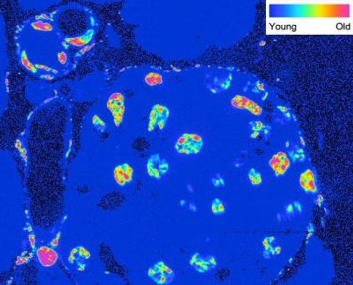 Isotope imaging of different cells inside an islet of Langerhans within the pancreas. Older cells have a yellow-to-pink color scheme, while younger cells exhibit a blue-to-green color pattern. / Credit: Salk Institute