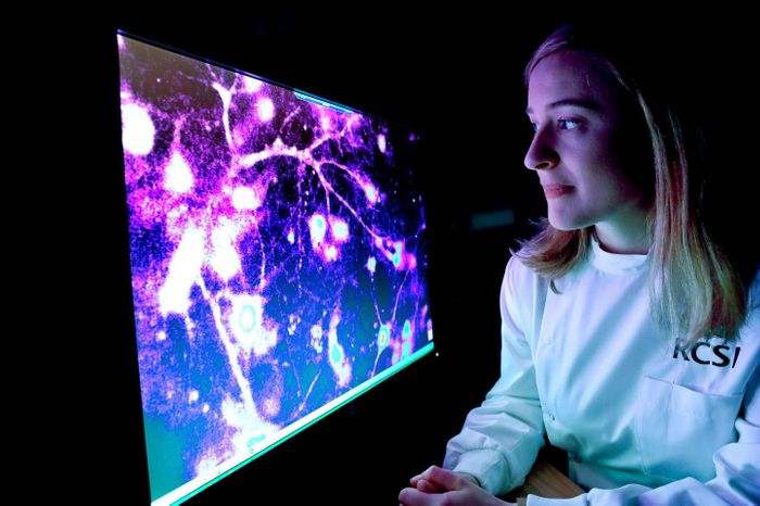Dr. Marion Hogg, Honorary Lecturer at RCSI and FutureNeuro investigator, found a pattern of molecules that appear in the blood before a seizure happens, which may lead to the development of an early warning system for those with epilepsy. / Credit: Maxwell Photography