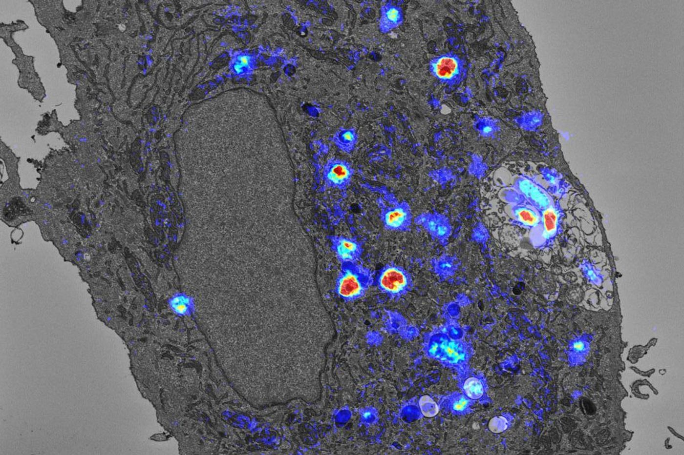 Scientists visualise the TB antibiotic bedaquiline inside lipid droplets (circles) and TB bacteria (rod shaped structures) inside human macrophages. / Credit: Daniel Greenwood, Francis Crick Institute