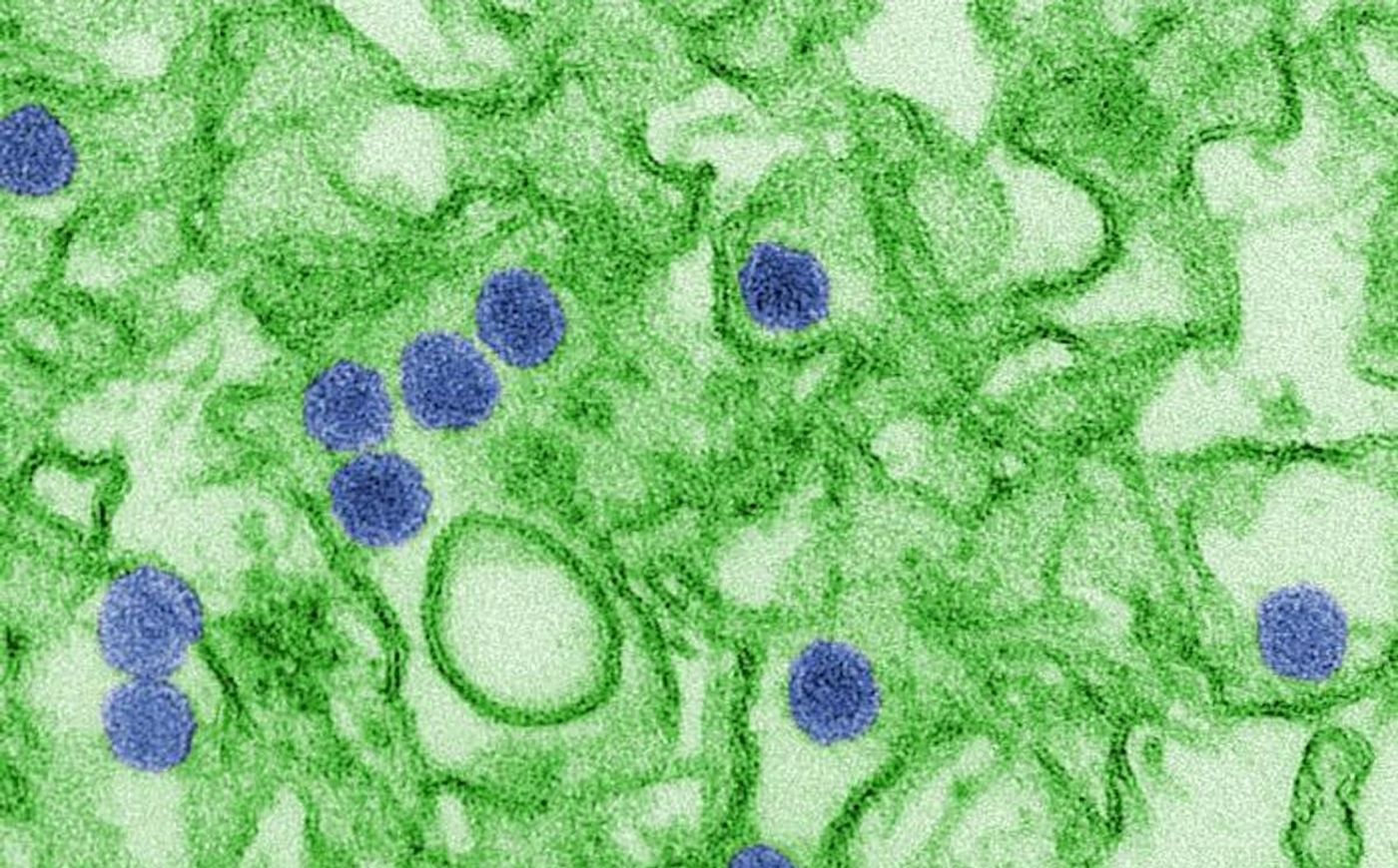Digitally-colorized transmission electron microscopic image of Zika virus, a member of the family Flaviviridae, grown in LLC-MK2 culture cells. Virus particles, here colored blue, are 40 nm in diameter, with an outer envelope, and an inner dense core./ Credit: CDC/ Cynthia Goldsmith