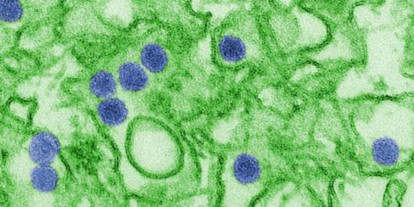 Digitally-colorized TEM image of Zika virus, a member of the family Flaviviridae, grown in LLC-MK2 culture cells. Virus particles (blue) are 40 nm in diameter, with an outer envelope, and an inner dense core. / Credit: CDC/ Cynthia Goldsmith