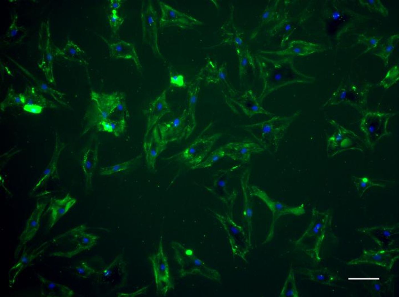 This is a schematic showing the interaction of the designer protein on the surface of the stem cell with heart fibronectin. / Credit: University of Bristol