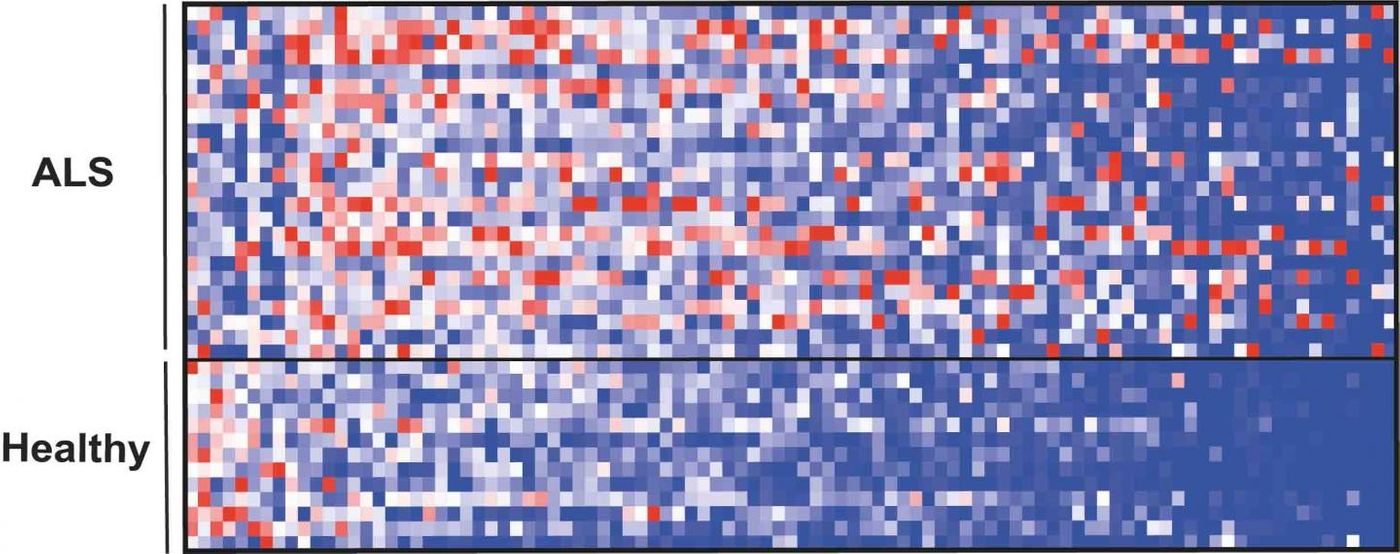 The repertoire of small molecules (metabolites) in blood, many of which originate in the microbiome, showed a different pattern in patients with ALS (top) compared with healthy individuals (bottom). / Credit: Weizmann Institute of Science