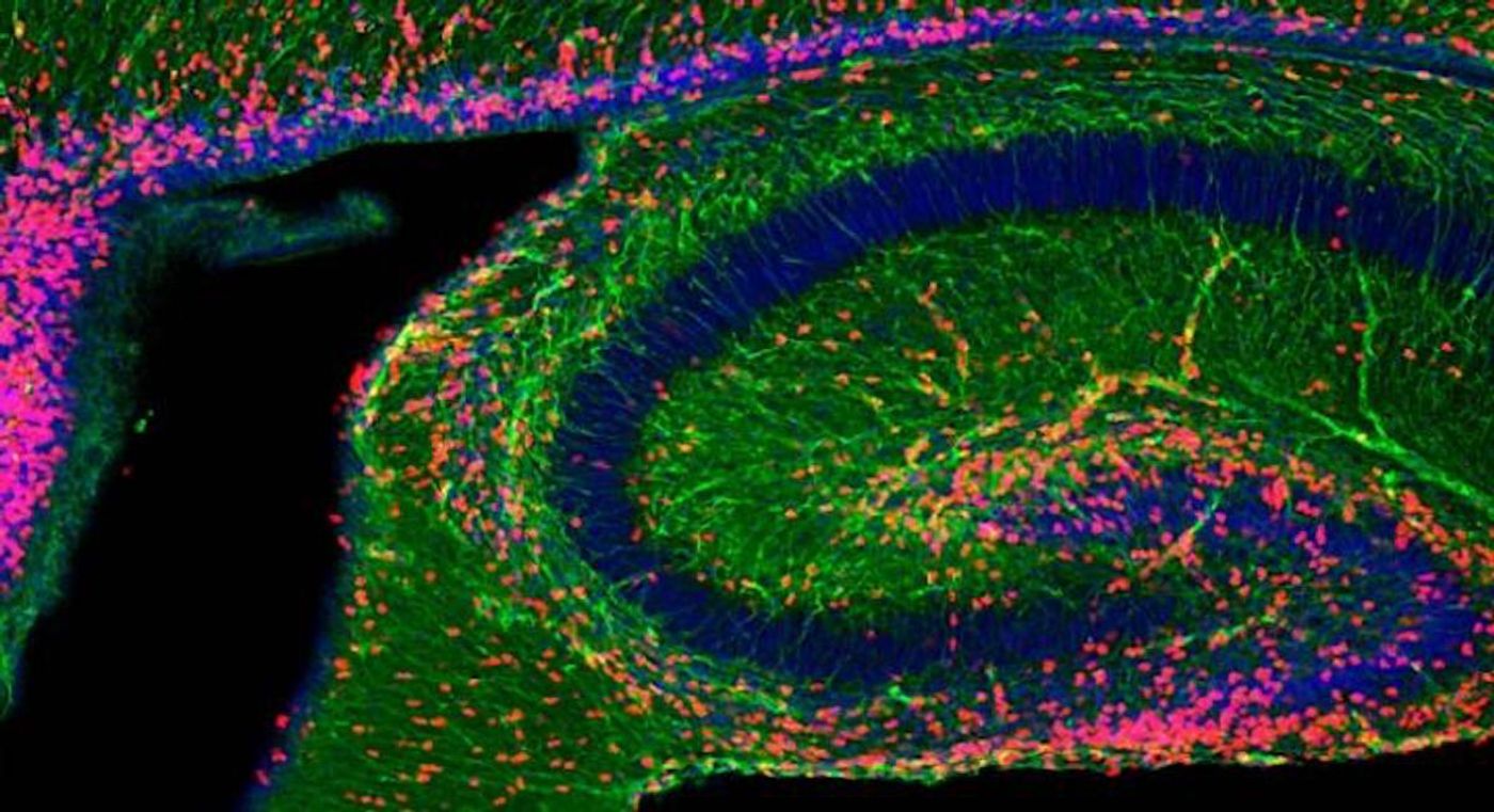 Neuron proliferation increased in the developing hippocampus of a mouse following an injection of neuronal exosomes. (Cell proliferation seen here in red.) / Credit: Cline lab at Scripps Research, La Jolla, California