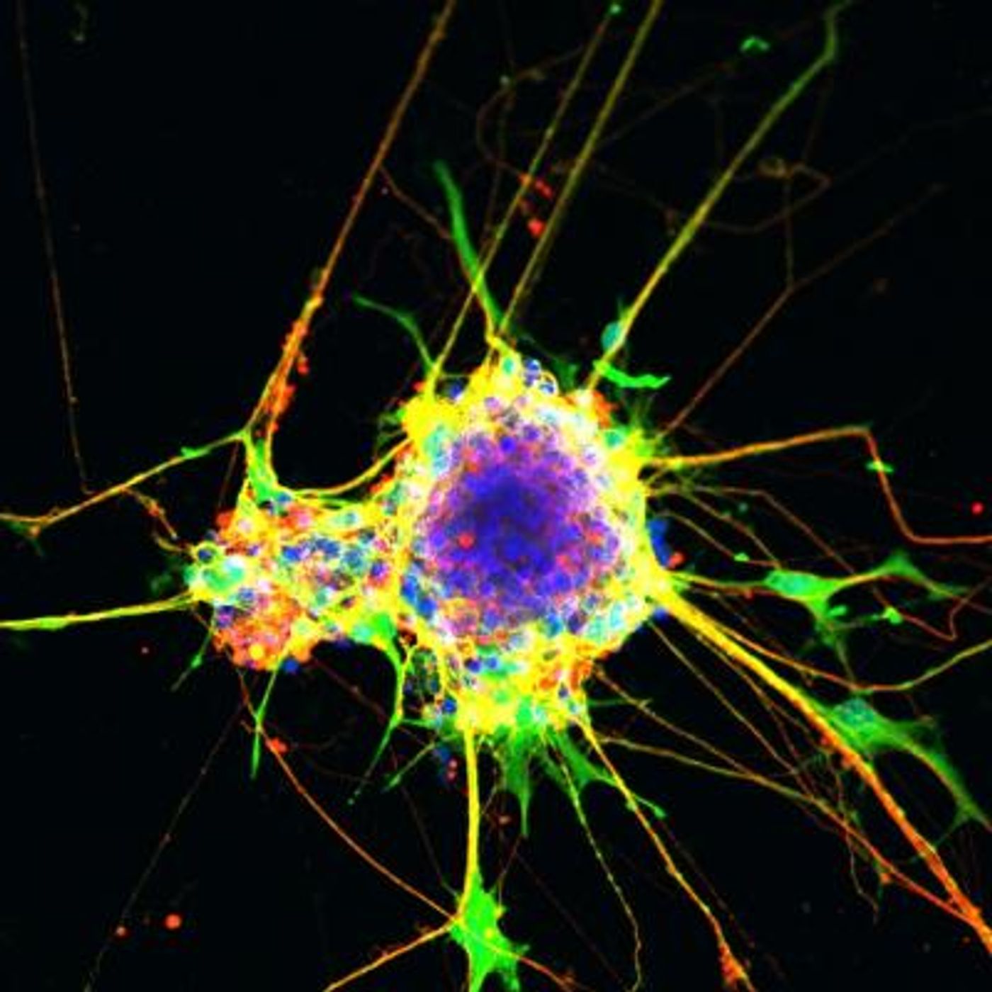 Neurons generated using the cell culture method described in the paper. / Credit: Salk Institute