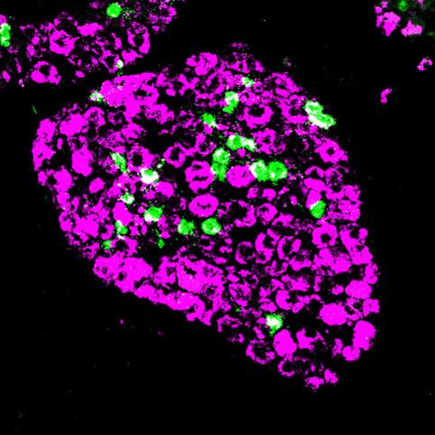 Nerves that stimulate skin are grouped in structures next to the spinal cord. Here, nerves in such a structure -- called a dorsal root ganglion -- that are involved in detecting an itch are labeled green. Nerves involved in sensing pain, temperature and other stimuli are shown in magenta. / Credit: Hans Juergen Solinski, National Institute of Dental and Craniofacial Research