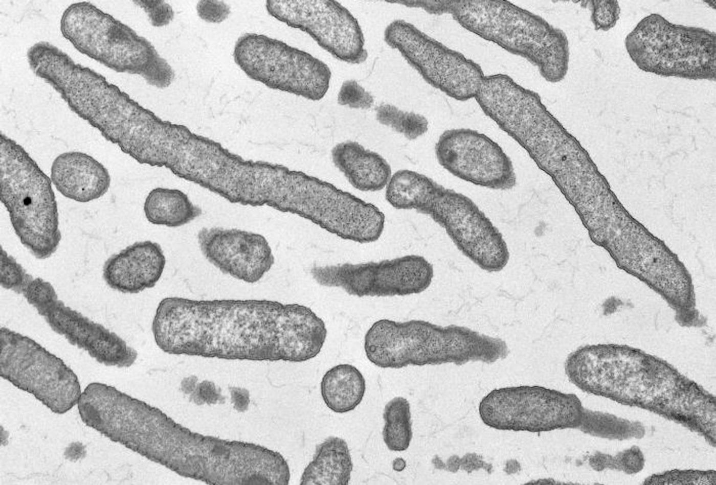 A TEM image depicting Elizabethkingia anophelis bacteria / Credit: CDC/ Cynthia Goldsmith and Melissa Bell