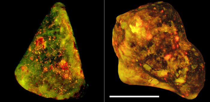 This figure shows neutrophil elastase (green) and DNA (red) co-localize on the surfaces of human gallstones (yellow). Scale bar 4mm. / Credit: Munoz et al./Immunity