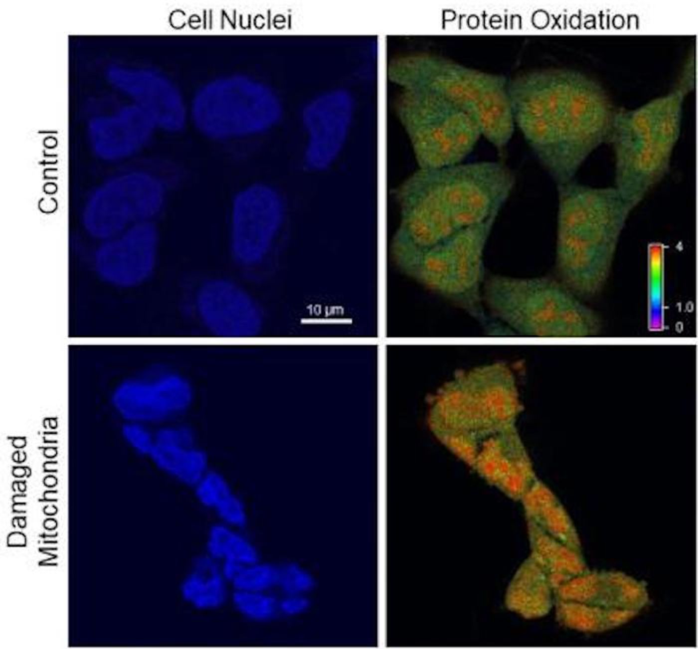 Reactive oxygen species pumped out by damaged mitochondria cause cell nuclei (blue) to oxidize (yellow) and shrivel. / Credit:  Qian et al. (2019), PNAS