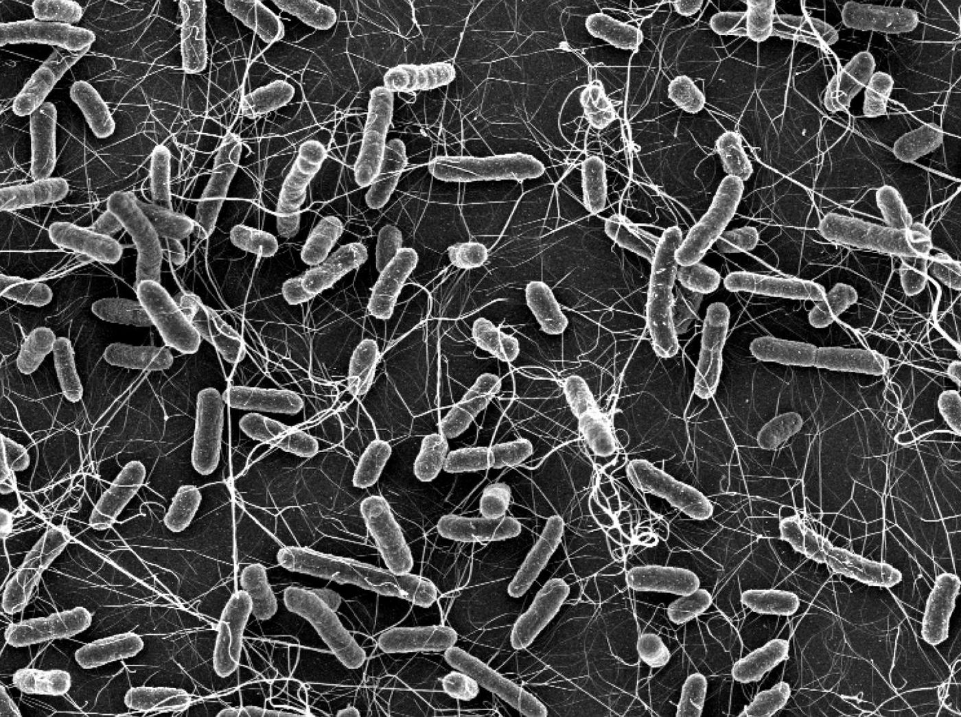 Salmonella causes diarrhoea in animals and humans. These bacteria become a particular public health concern if they are resistant to antibiotics (electron microscopic photograph). / Credit: ETH Zurich / Stefan Fattinger