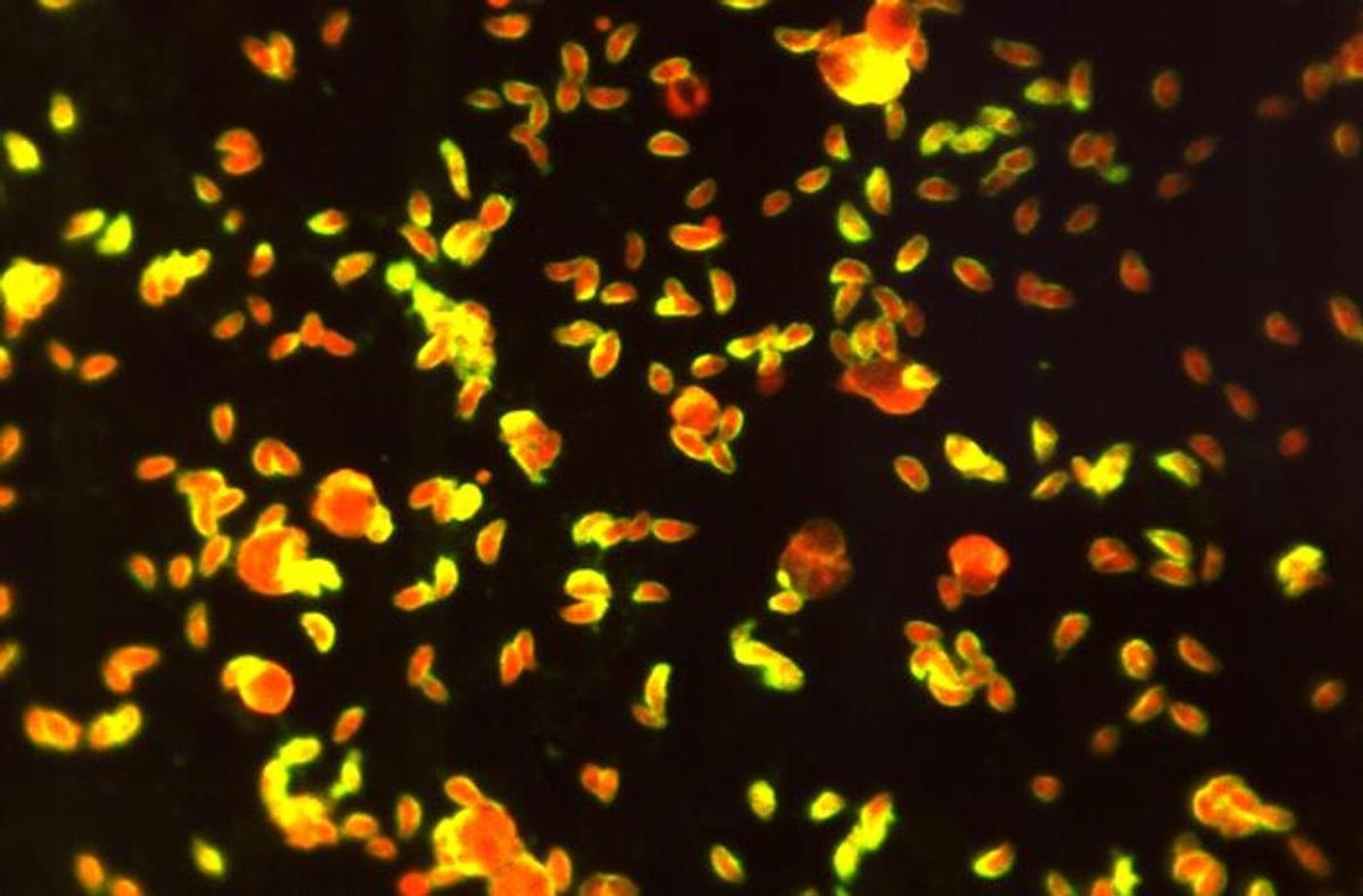 A 570x photomicrograph revealing numerous, Toxoplasma sp. tachyzoites, interpreted as a positive reaction for antibodies to T. gondii. In this case, the yellow-colored fluorescence does extended around the entire periphery of each organism./ Credit: CDC