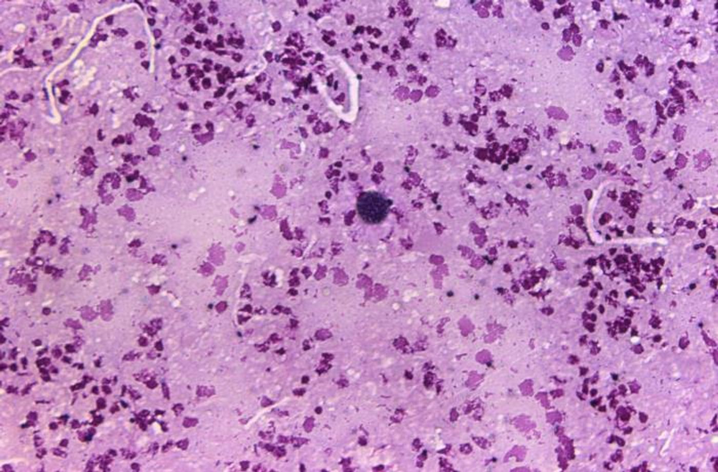 Toxoplasma gondii tissue cyst / Credit: CDC/Dr Green