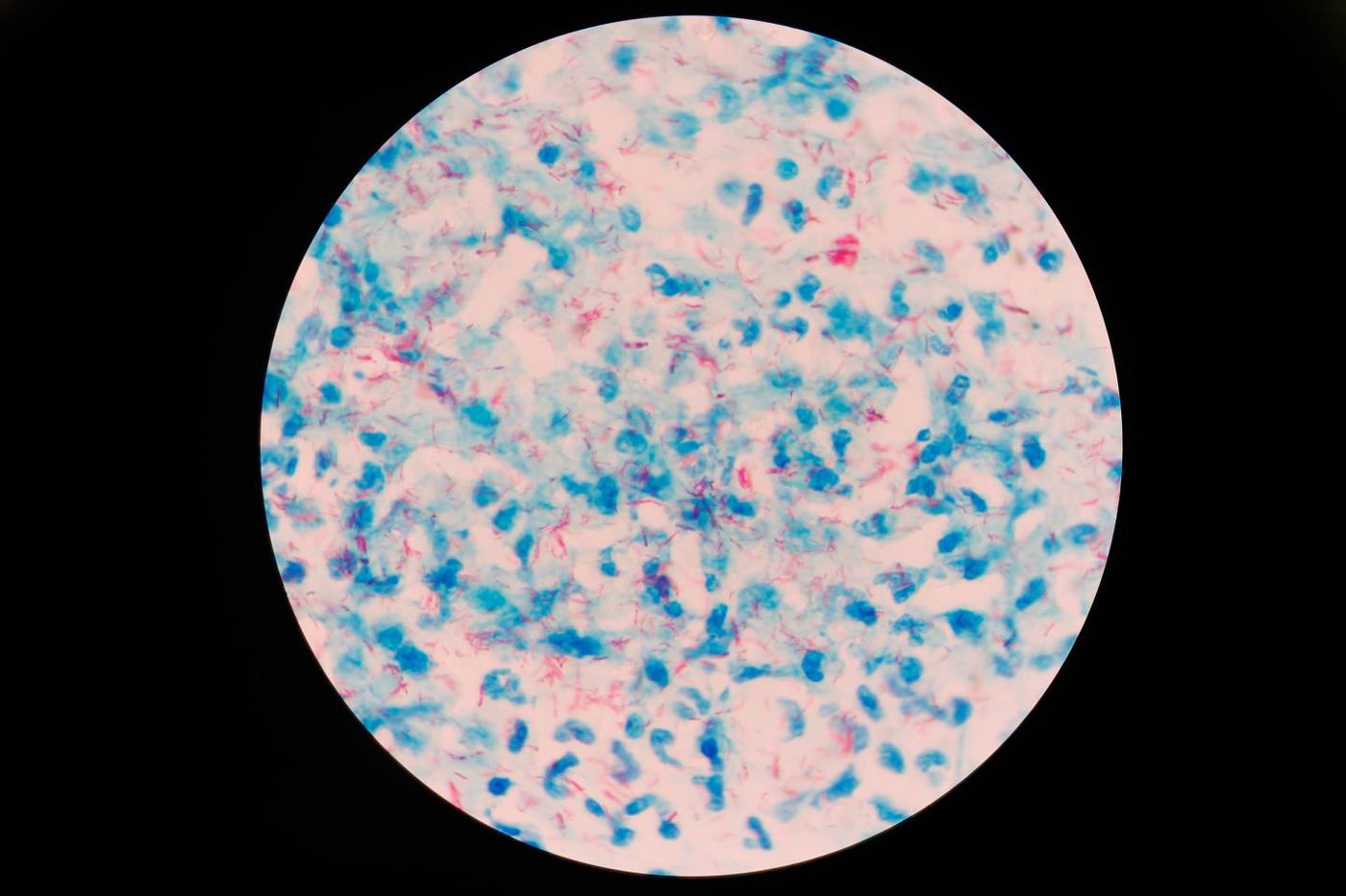 Mycobacterium tuberculosis (Mtb) under a microscope. / Credit: Texas Biomedical Research Institute