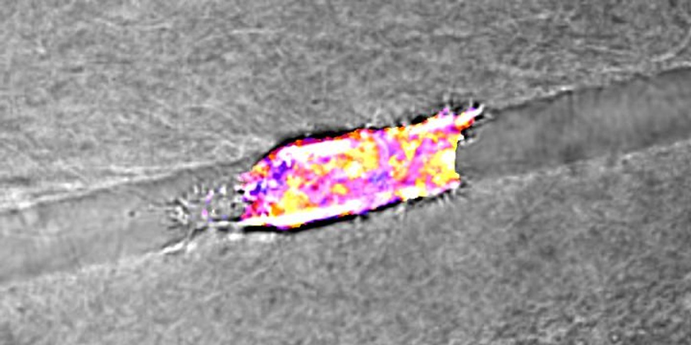 A cancer cell migrating through a collagen track with fluorescent biomarkers showing cellular energy levels assigned a hue on the color spectrum from purple (low energy) to yellow (high energy). / Credit: Reinhart-King Lab / Vanderbilt University
