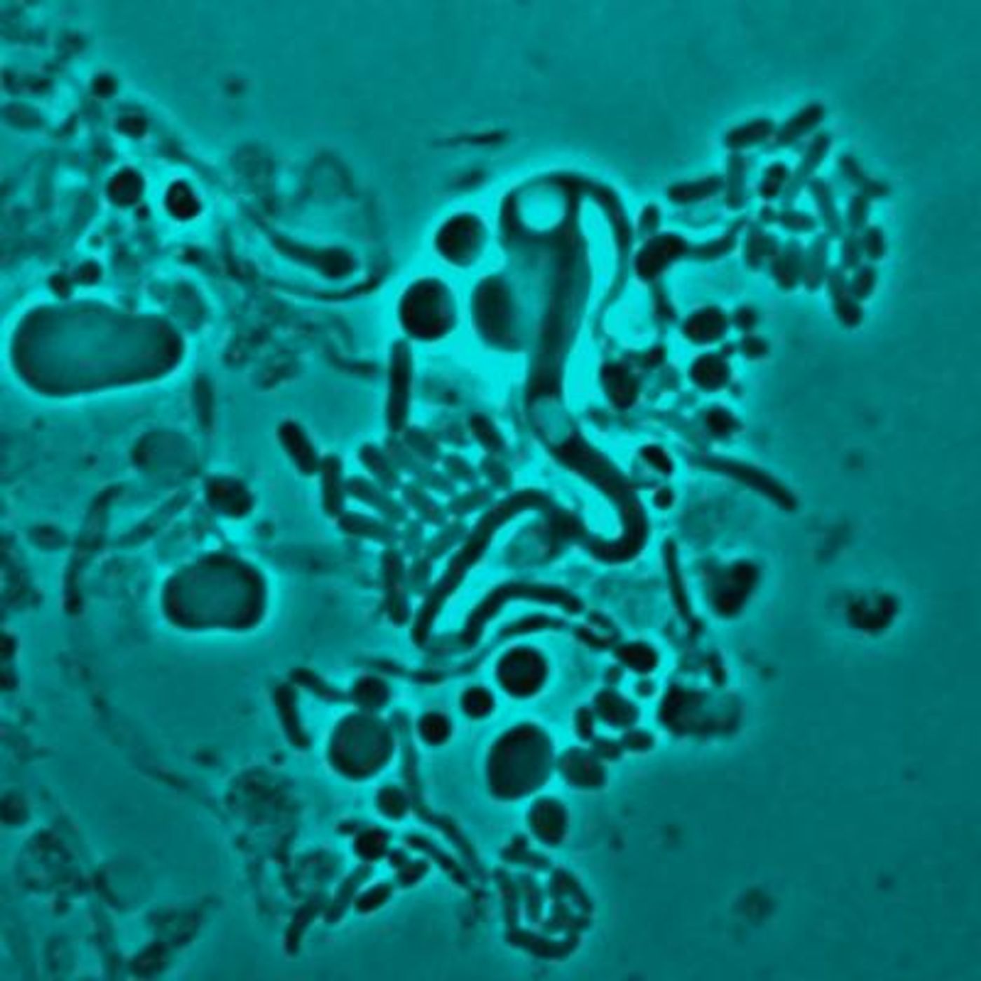 E.coli L-form switching - so from walled to without a wall / Credit: Newcastle University, UK